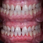 Periodontia | Consultório Dr. Bernardo Resende